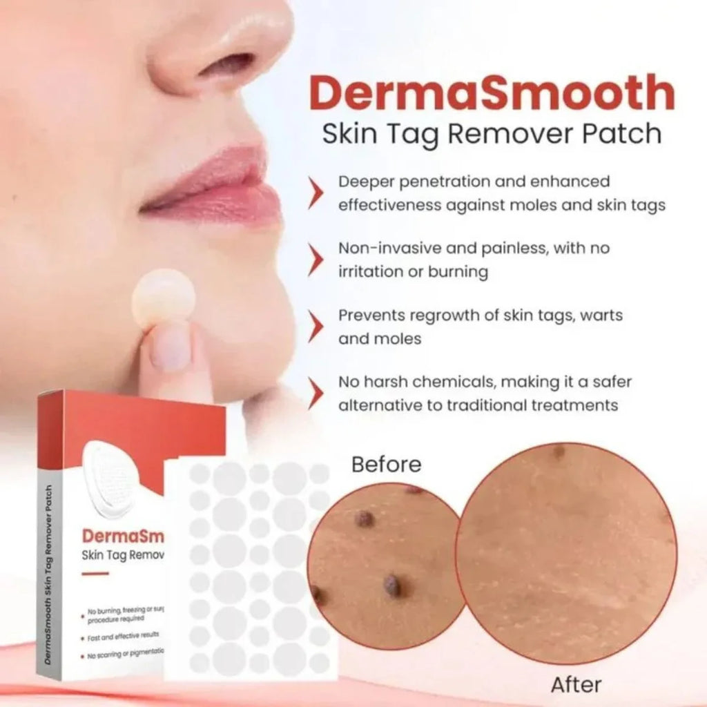 DermaSmooth Skin Tag Patches - 72 Pack