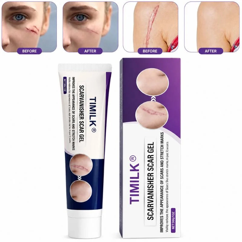 TIMILK Scar Vanisher Gel 30g