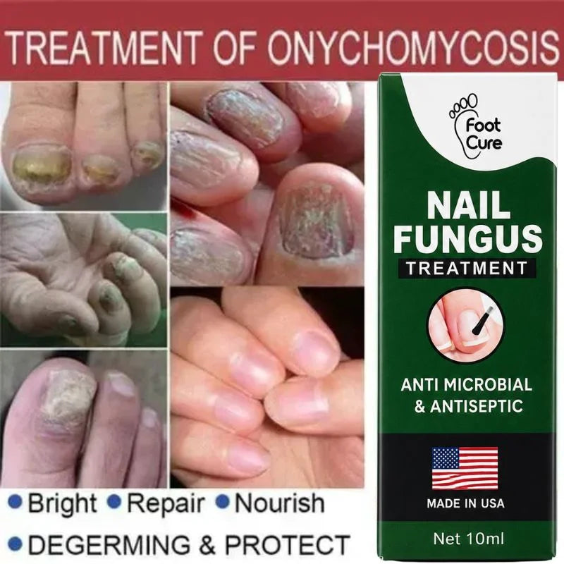 Nail Care Serum for Fingernails & Toenails - 10ml