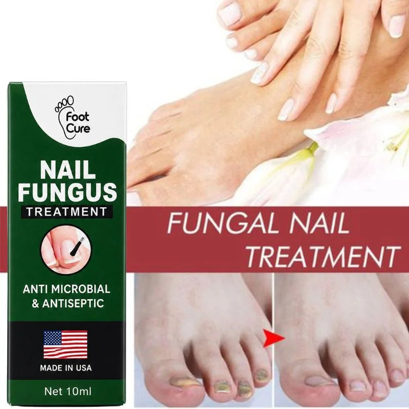 Nail Care Serum for Fingernails & Toenails - 10ml