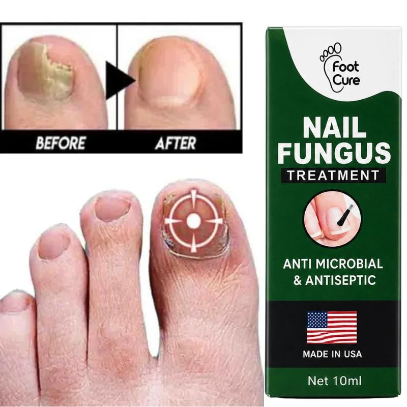 Nail Care Serum for Fingernails & Toenails - 10ml
