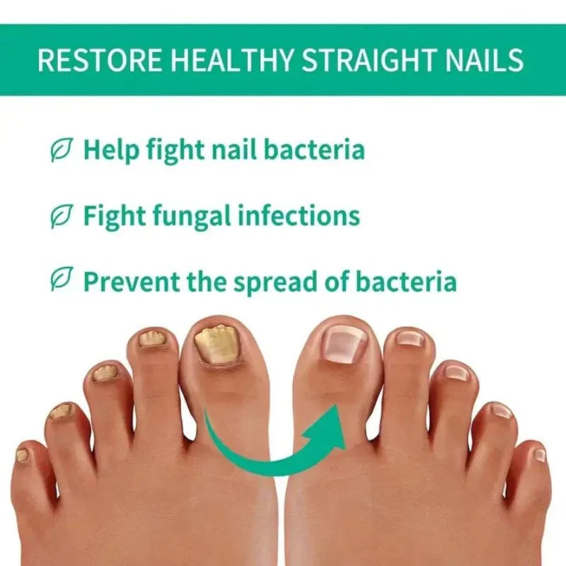 Nail Care Serum for Fingernails & Toenails - 10ml