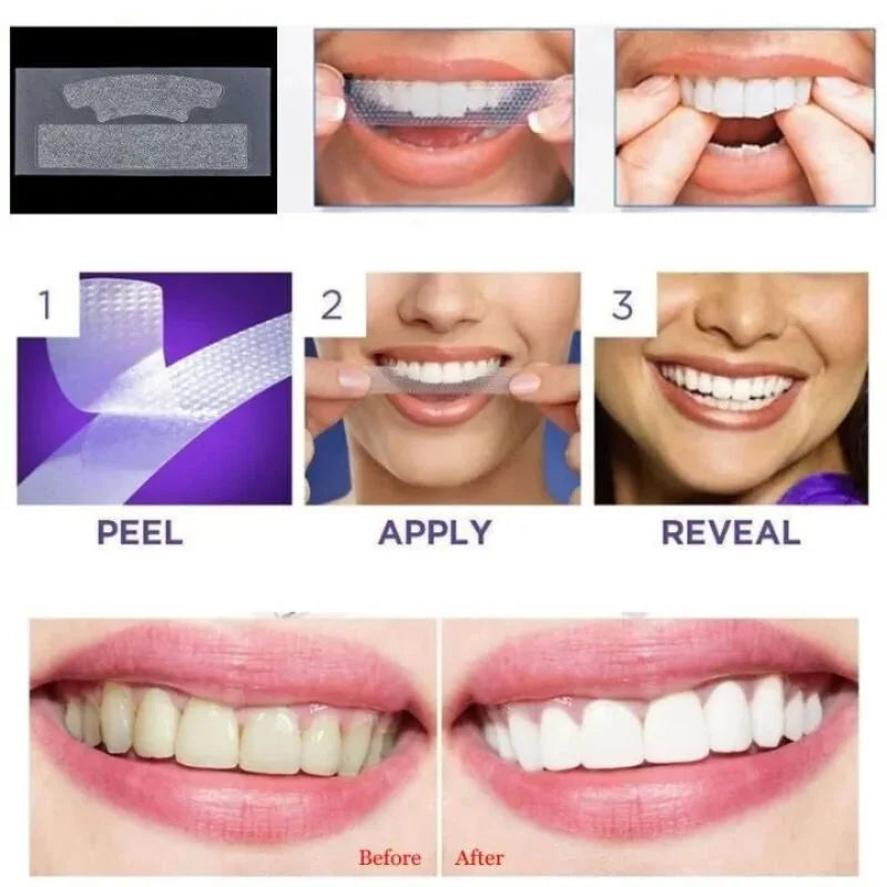Gegemoon 3D Teeth Whitening Strips - 7 Pairs