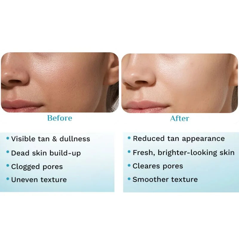 Pilgrim 32% AHA BHA PHA Peeling Solution - 30ml