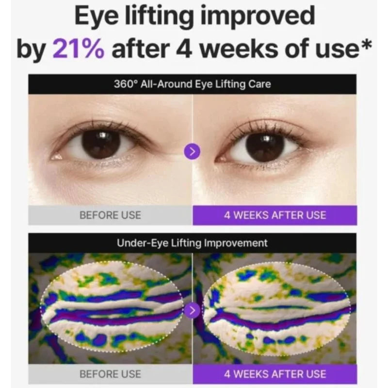Centellian24 PDRN Lifting Eye Cream - 30ml