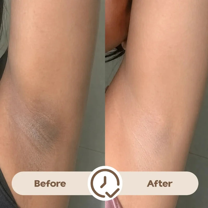 Ray Time To Shine Underarm Serum - 30ml
